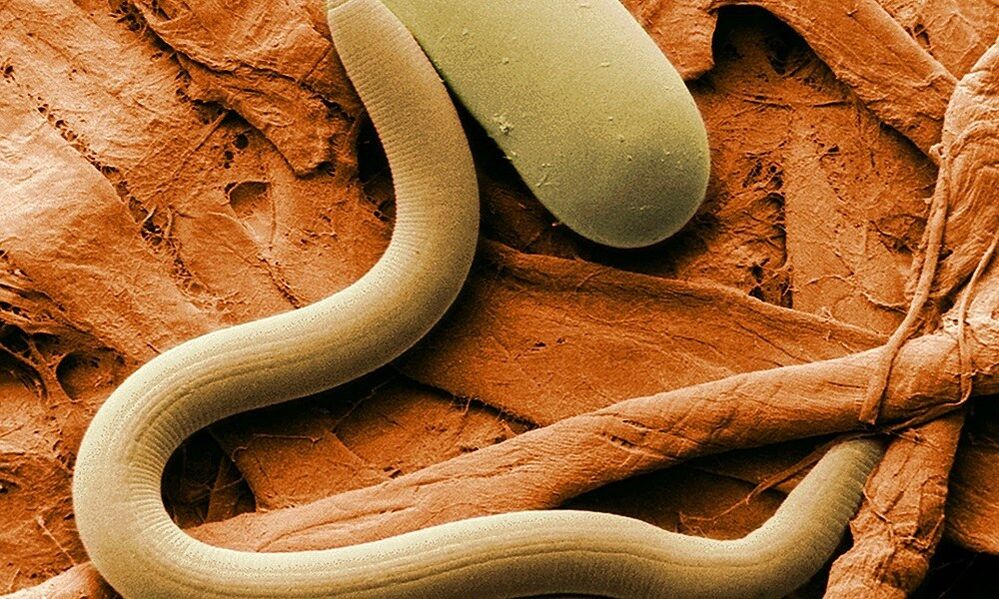 a worm parasite of the human body