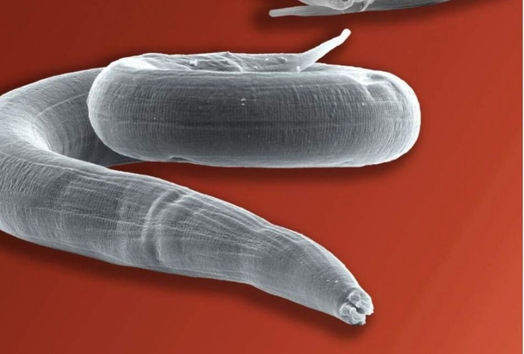 sedges from the human body