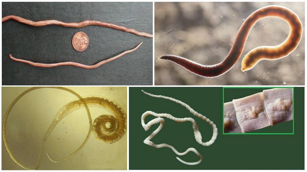 Types of worms in the human body