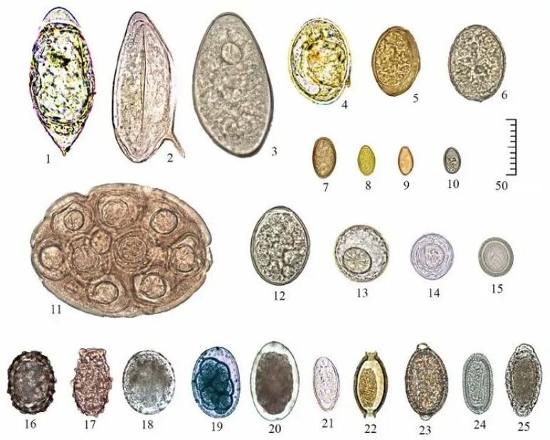 shape and size of eggs of various helminths