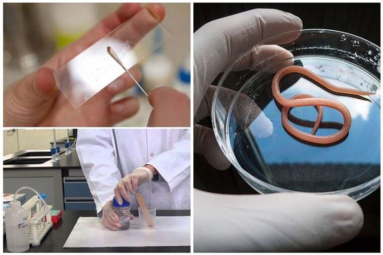tests for the presence of worms in the body